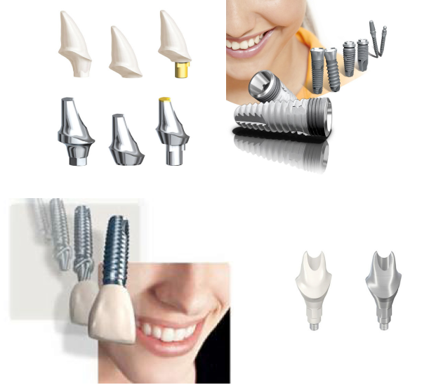 Dental Implants Boise Treasure Dental Lab Boise, Eagle, Meridian